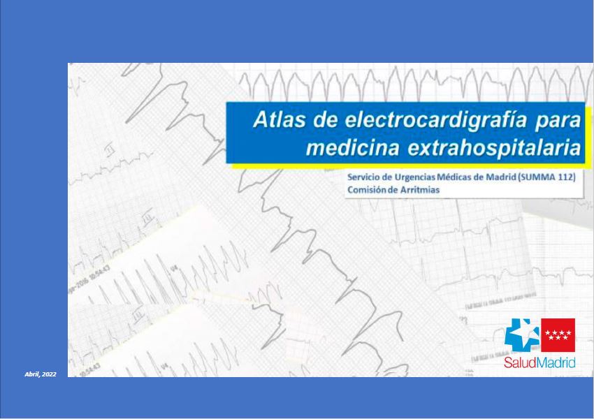 Portada de Atlas de electrocardiografía para medicina extrahospitalaria (Summa 112)